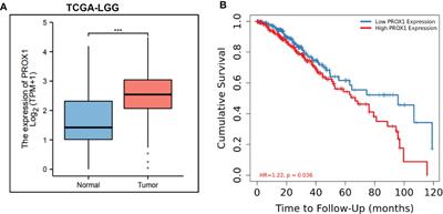 Triptolide inhibits the progression of Glioblastoma U251 cells via targeting PROX1